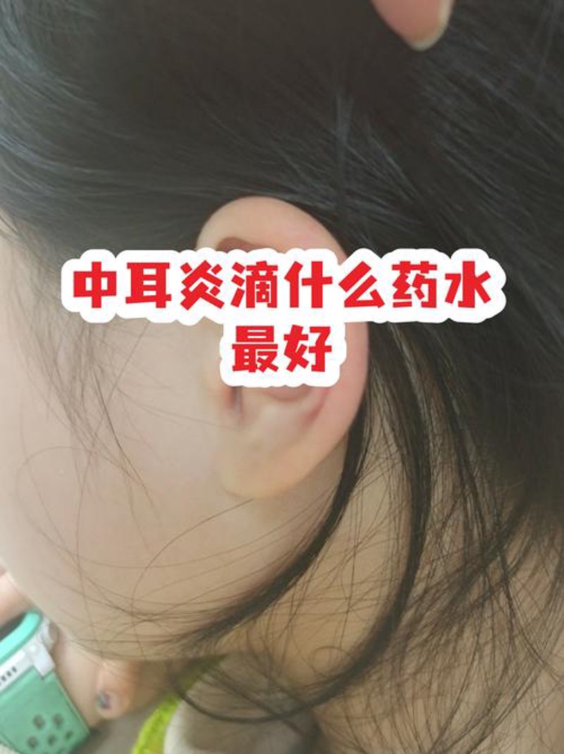 中耳炎治疗