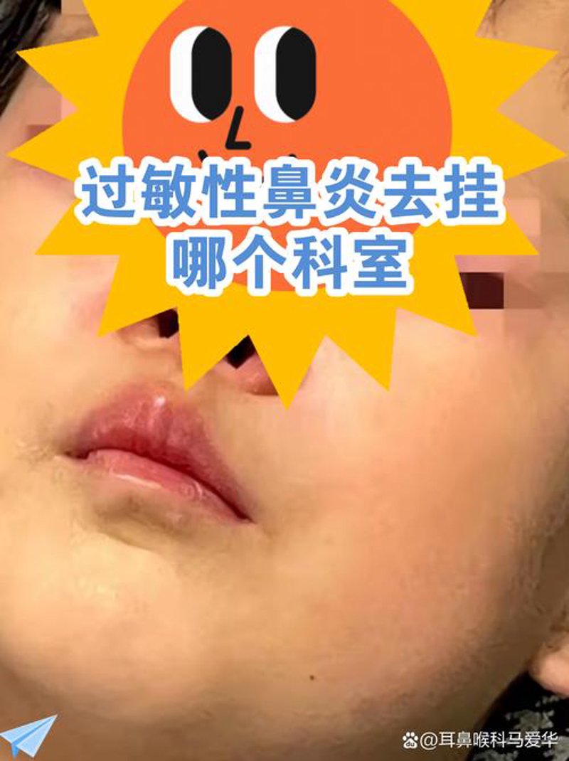南京鼻炎医院