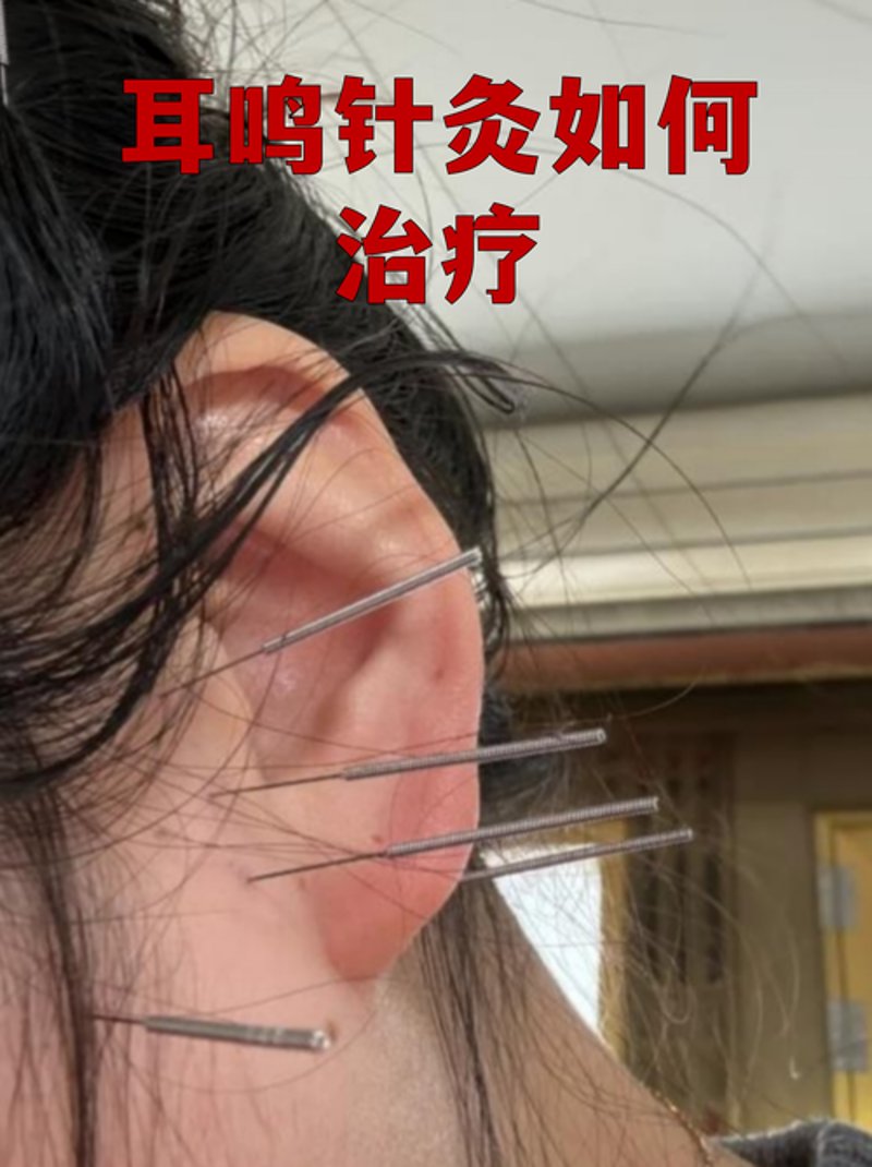 南京耳鼻喉医院哪家好?精选一份全面选择指南