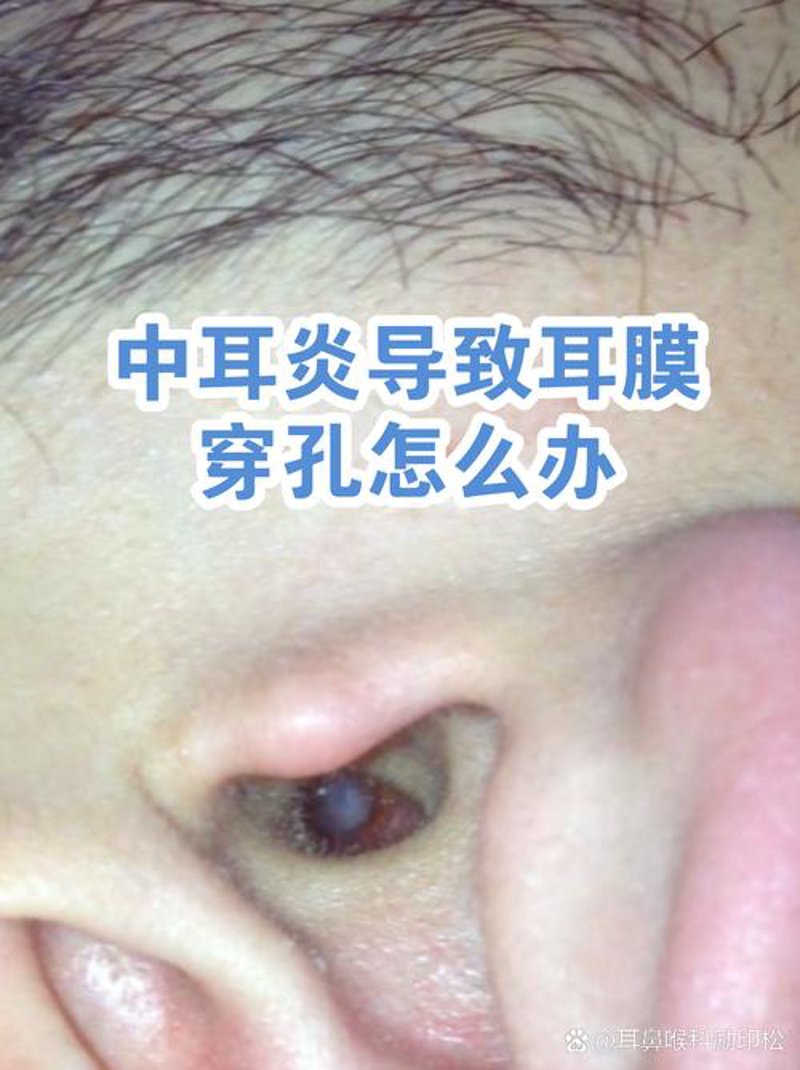 选择耳鼻喉专科医院的三大法宝