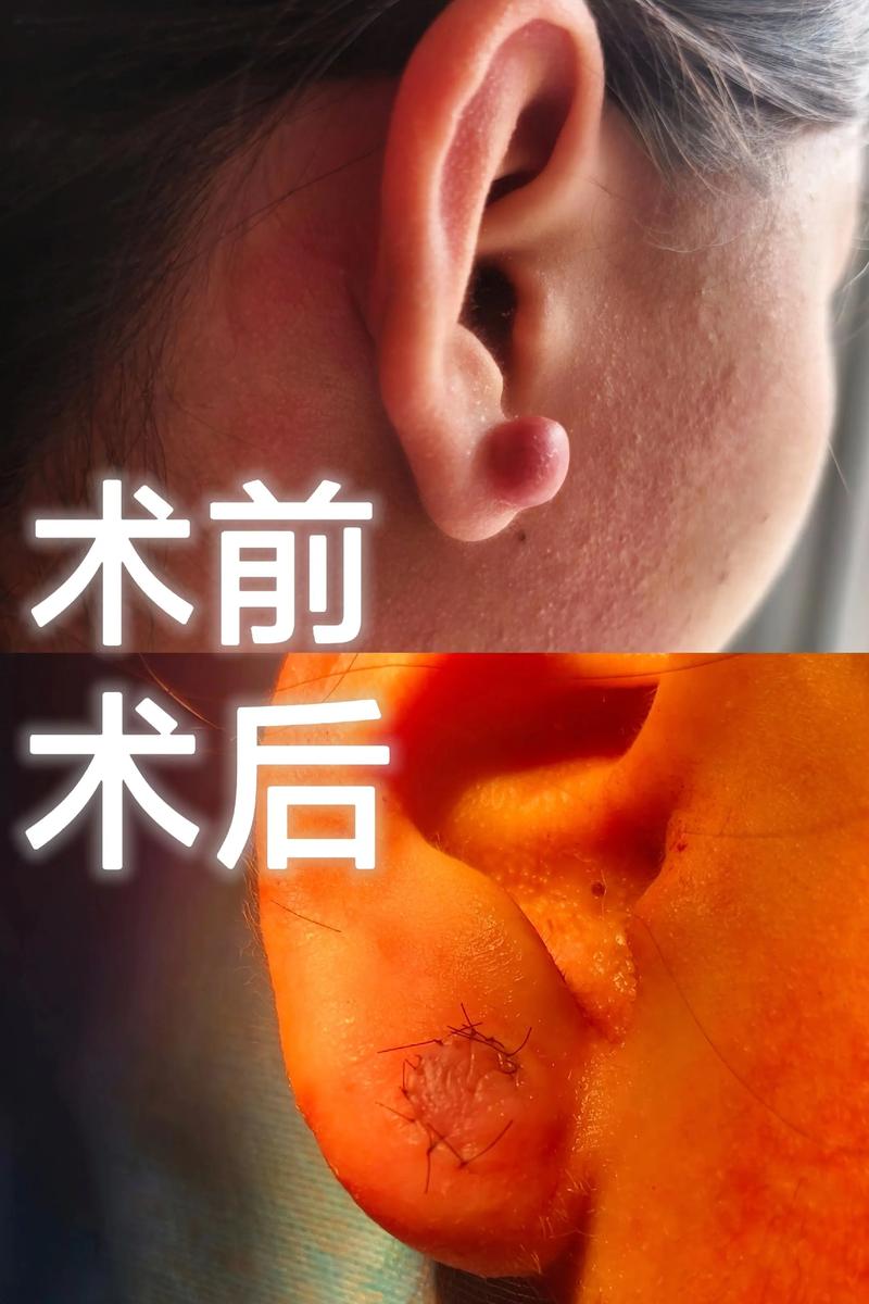 警惕耳鼻喉科就诊误区，省人民医院专家支招